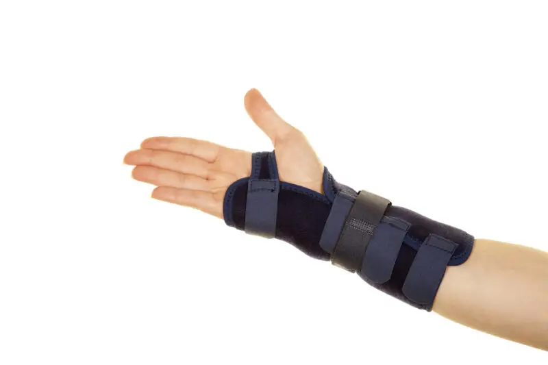 Fracture of arm Schmerzsprechstunde